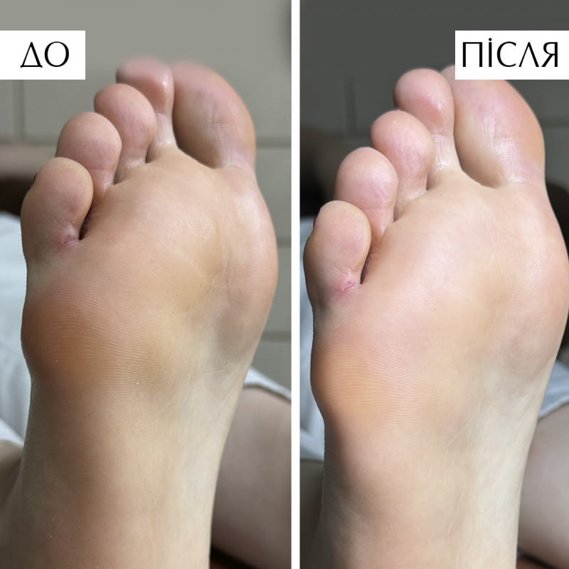 Molecular Pedicure Oil / Mолекулярна Олійка для педикюру PNB, 50 мл