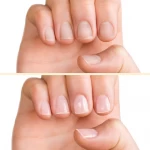 Pink Nail Treatment PNB, 15 ml